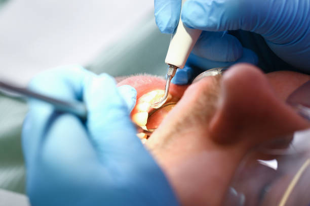 Best Emergency Dental Care for Sports Injuries in Amador Pines, CA