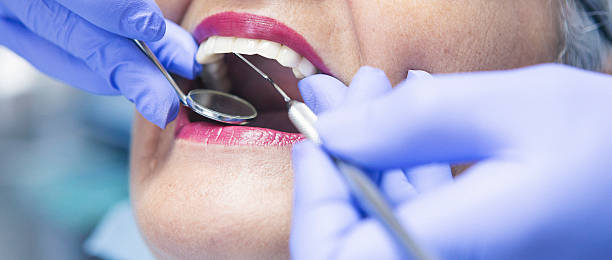 Best Knocked-Out Tooth (Avulsed Tooth) Treatment in Amador Pines, CA