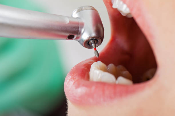 Best Emergency Orthodontic Repairs in Amador Pines, CA